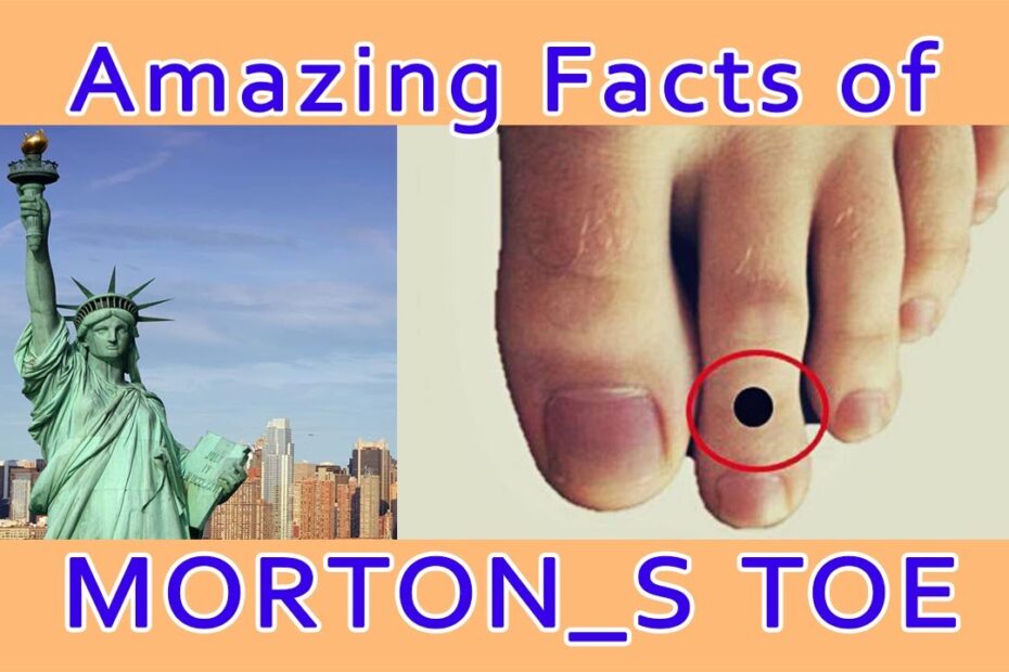 Morton's Toe Spiritual Meaning